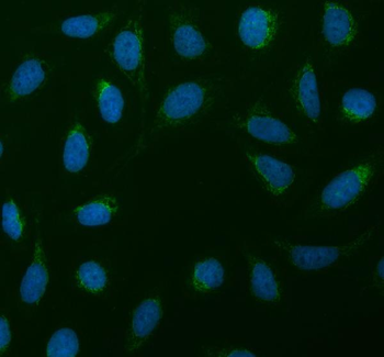 SDHA Rabbit Polyclonal Antibody