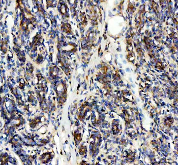 SDHA Rabbit Polyclonal Antibody
