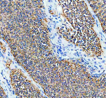 SDHA Rabbit Polyclonal Antibody