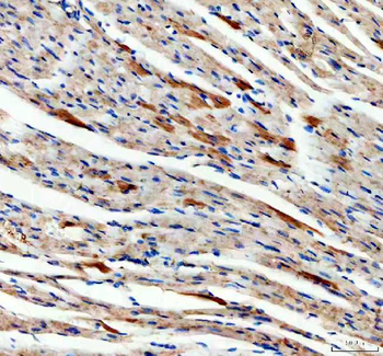 SDHA Rabbit Polyclonal Antibody