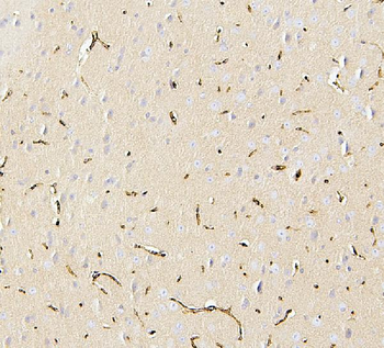Glucose Transporter GLUT1/SLC2A1 Rabbit Polyclonal Antibody