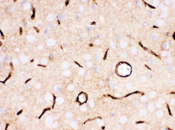 Glucose Transporter GLUT1/SLC2A1 Rabbit Polyclonal Antibody