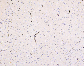 Glucose Transporter GLUT1/SLC2A1 Rabbit Polyclonal Antibody