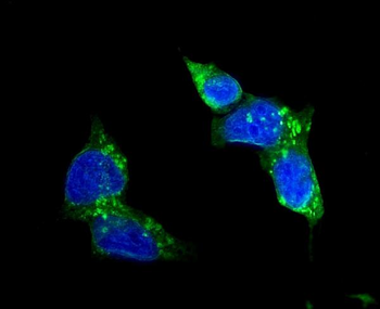 Glucose Transporter GLUT1/SLC2A1 Rabbit Polyclonal Antibody