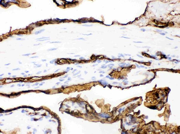 Glucose Transporter GLUT1/SLC2A1 Rabbit Polyclonal Antibody