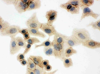 Glucose Transporter GLUT1/SLC2A1 Rabbit Polyclonal Antibody