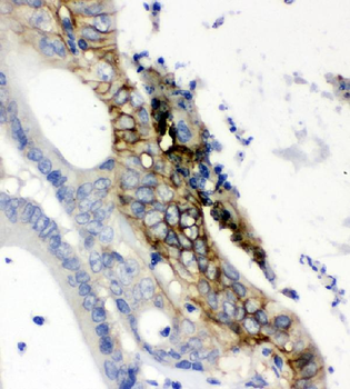 Glucose Transporter GLUT1/SLC2A1 Rabbit Polyclonal Antibody