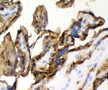 Glucose Transporter GLUT1/SLC2A1 Rabbit Polyclonal Antibody