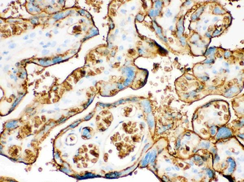 Glucose Transporter GLUT1/SLC2A1 Rabbit Polyclonal Antibody