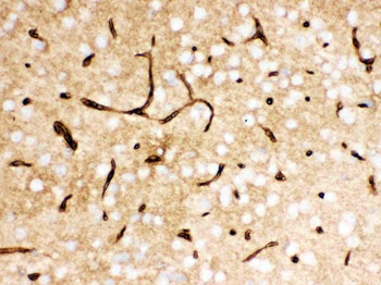 Glucose Transporter GLUT1/SLC2A1 Rabbit Polyclonal Antibody