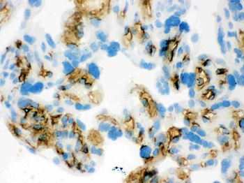 SLC4A1/CD233/Band 3 Rabbit Polyclonal Antibody