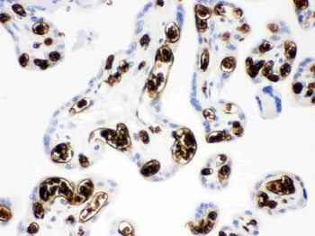 SLC4A1/CD233/Band 3 Rabbit Polyclonal Antibody