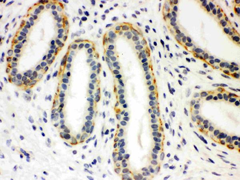 Serotonin transporter/SLC6A4 Rabbit Polyclonal Antibody