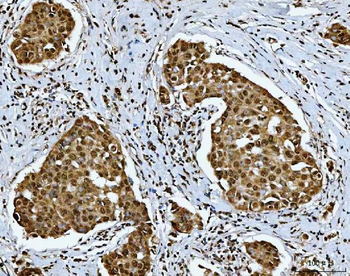 SNRPN Rabbit Polyclonal Antibody