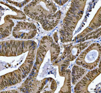 SNRPN Rabbit Polyclonal Antibody
