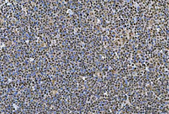 SNRPN Rabbit Polyclonal Antibody