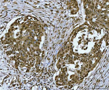 SNRPN Rabbit Polyclonal Antibody