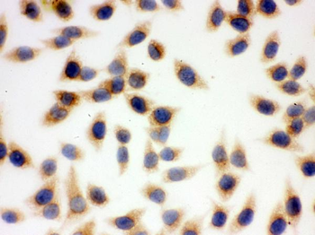 SOD2 Rabbit Polyclonal Antibody