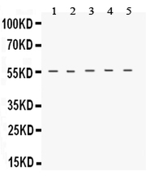 Neurokinin 1 Receptor/TACR1 Rabbit Polyclonal Antibody