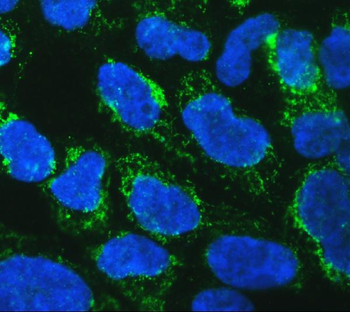 mtTFA/TFAM Rabbit Polyclonal Antibody