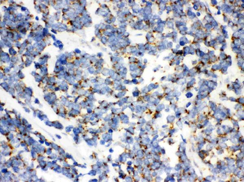 mtTFA/TFAM Rabbit Polyclonal Antibody