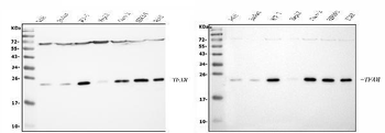 mtTFA/TFAM Rabbit Polyclonal Antibody