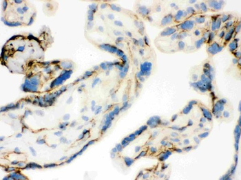 Transglutaminase 2/TGM2 Rabbit Polyclonal Antibody