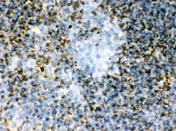 Transglutaminase 2/TGM2 Rabbit Polyclonal Antibody