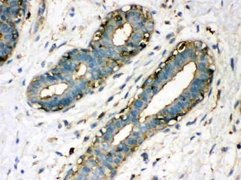 Transglutaminase 2/TGM2 Rabbit Polyclonal Antibody