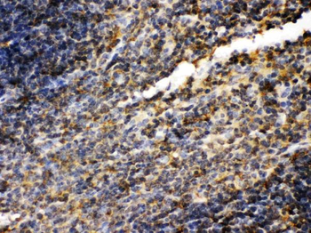 Transglutaminase 2/TGM2 Rabbit Polyclonal Antibody