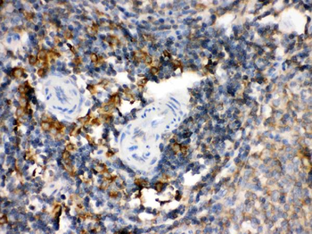 Transglutaminase 2/TGM2 Rabbit Polyclonal Antibody