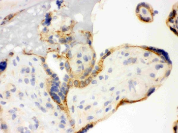 TLR7 Rabbit Polyclonal Antibody