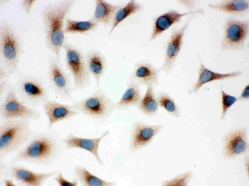 TLR7 Rabbit Polyclonal Antibody