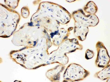 TLR7 Rabbit Polyclonal Antibody