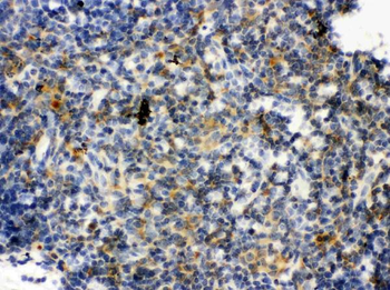 TLR7 Rabbit Polyclonal Antibody