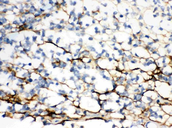 Versican/VCAN Rabbit Polyclonal Antibody