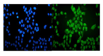 VCP Rabbit Polyclonal Antibody