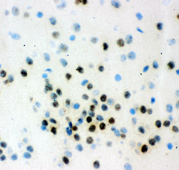 VCP Rabbit Polyclonal Antibody