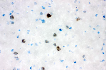 VCP Rabbit Polyclonal Antibody
