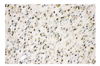 VCP Rabbit Polyclonal Antibody