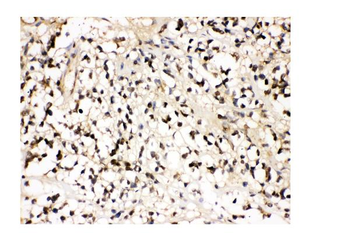 VCP Rabbit Polyclonal Antibody