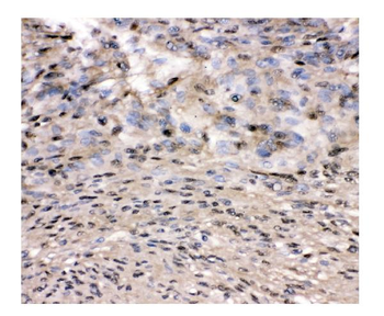 VCP Rabbit Polyclonal Antibody