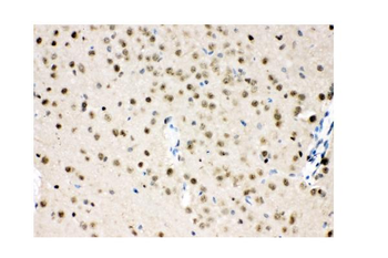 VCP Rabbit Polyclonal Antibody