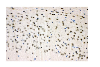 VCP Rabbit Polyclonal Antibody