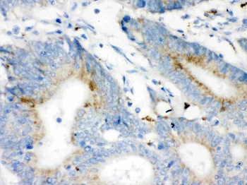 VDAC/Porin/VDAC1 Rabbit Polyclonal Antibody