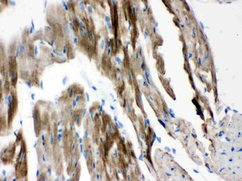 VDAC/Porin/VDAC1 Rabbit Polyclonal Antibody