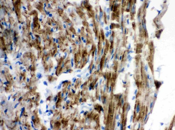 VDAC/Porin/VDAC1 Rabbit Polyclonal Antibody