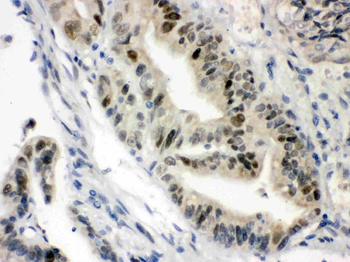 Vitamin D Receptor/VDR Rabbit Polyclonal Antibody