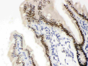 Vitamin D Receptor/VDR Rabbit Polyclonal Antibody