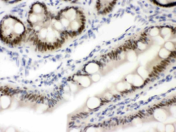 Vitamin D Receptor/VDR Rabbit Polyclonal Antibody